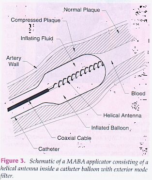 Treating Cardiac Disease